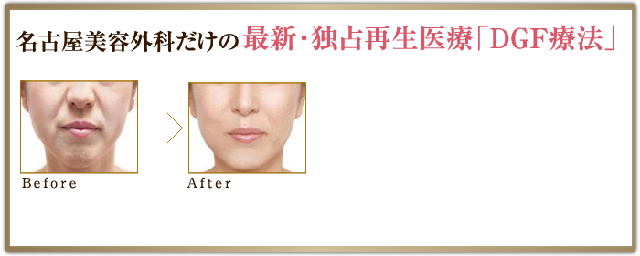 最新･独占再生医療「DGF療法」