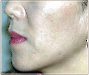 soft_a